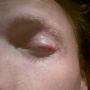 Dit hoort niet op mijn oog. En het wordt steeds groter... :S