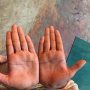 The hands of the girl I gave the rice and money to. ...