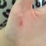 Broke the handles off two of my favorite mugs whilst washing up. And I damaged myself 